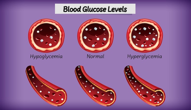 Vetor grátis nível de glicose no sangue médico