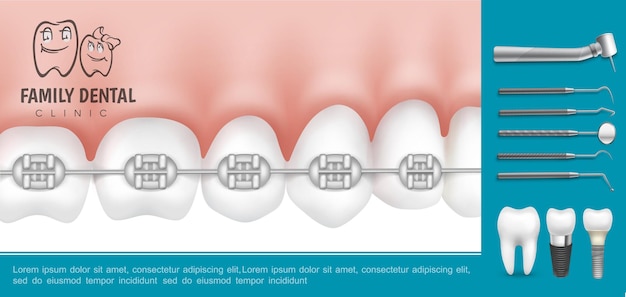 Odontologia realista e composição de estomatologia com aparelho de metal nos dentes, instrumentos médicos estomatológicos e implantes dentários Vetor grátis