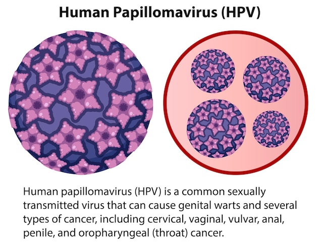 Vetor grátis papilomavírus humano com explicação
