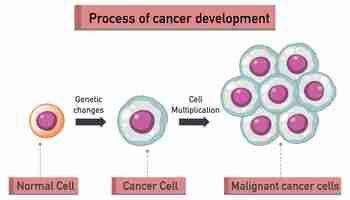 Vetor grátis processo de infográfico de desenvolvimento de câncer