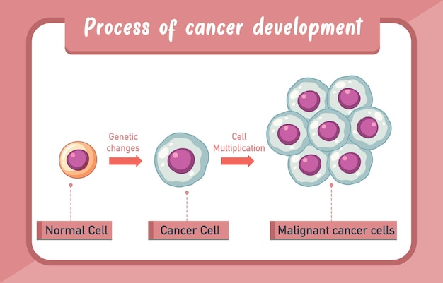 Processo de infográfico de desenvolvimento de câncer