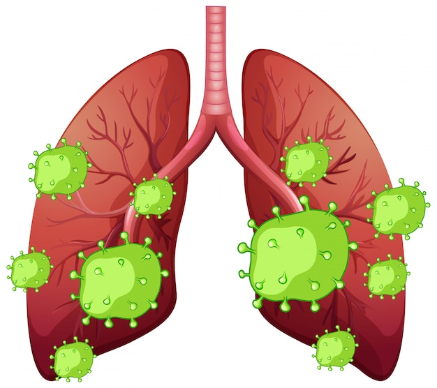 Vetor grátis pulmões humanos e células de coronavírus em fundo branco