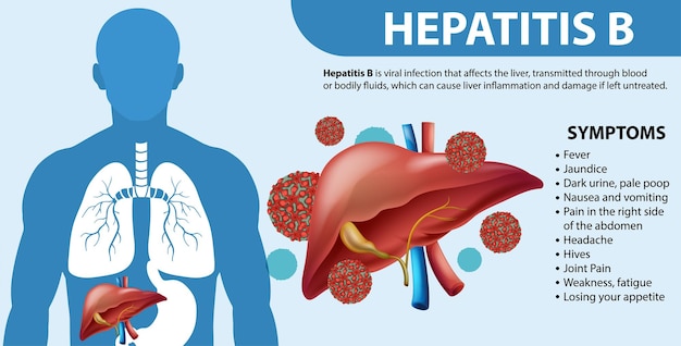 Vetor grátis sintomas da hepatite b infográfico