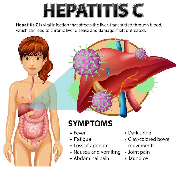 Vetor grátis sintomas da hepatite c