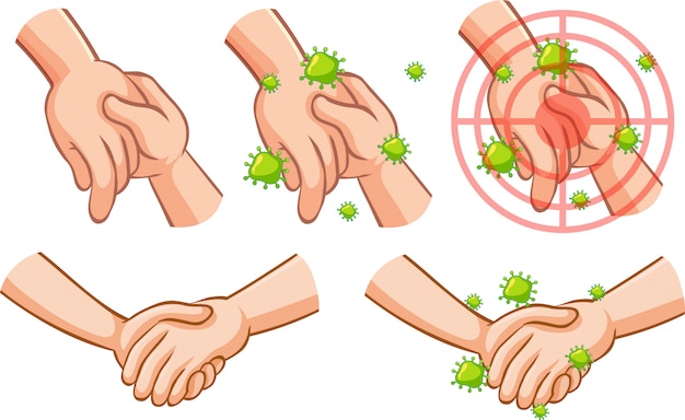 Tema de coronavírus com a mão cheia de germes tocando a outra mão