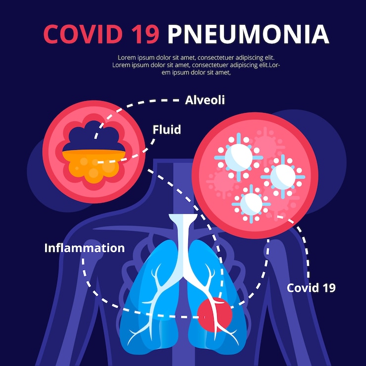 Vetor grátis tema de pneumonia por coronavírus