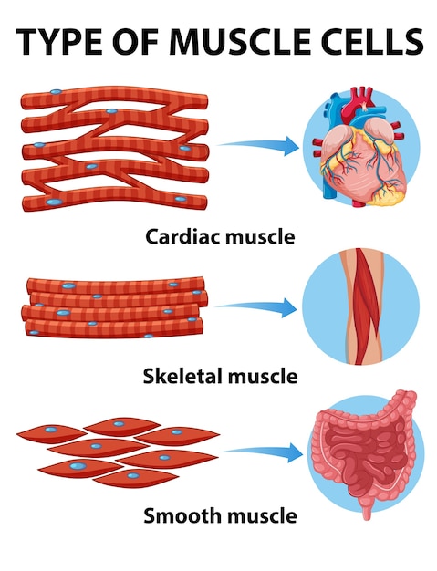 Tipo de células musculares