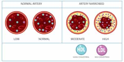 Vetor grátis tipos de colesterol hdl e ldl