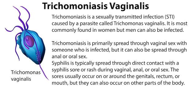 Vetor grátis tricomoníase vaginal com explicação