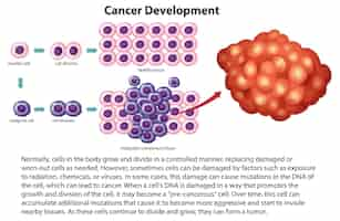 Vetor grátis vetor de desenvolvimento de câncer com informações