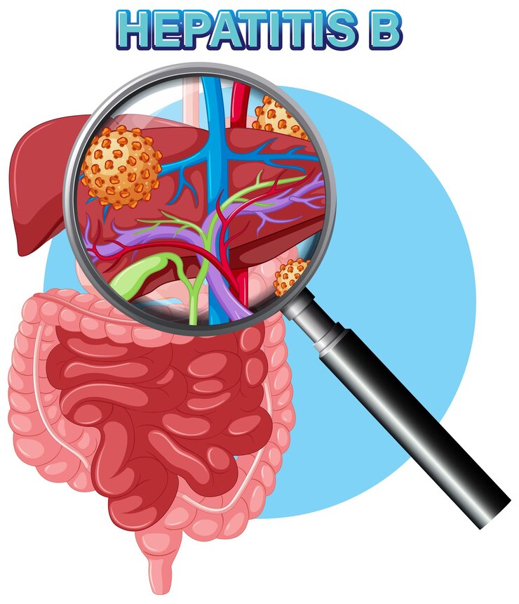 Vetor grátis vírus da infecção hepática da hepatite b