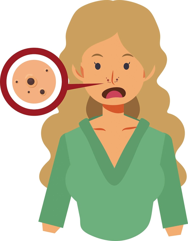 Vetor acne journey adolescente infeliz com espinhas desenho gráfico isolado