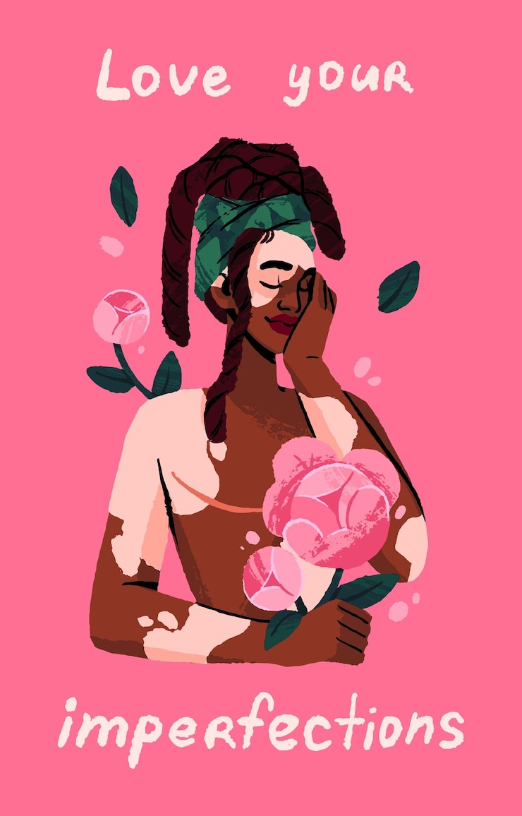 Vetor ama o seu corpo e aceite o conceito de imperfeições uma mulher feliz com vitiligo segura flores uma menina bonita com manchas abraça-se uma pessoa feminina cuida de si mesma cartão postal ilustração vetorial plana