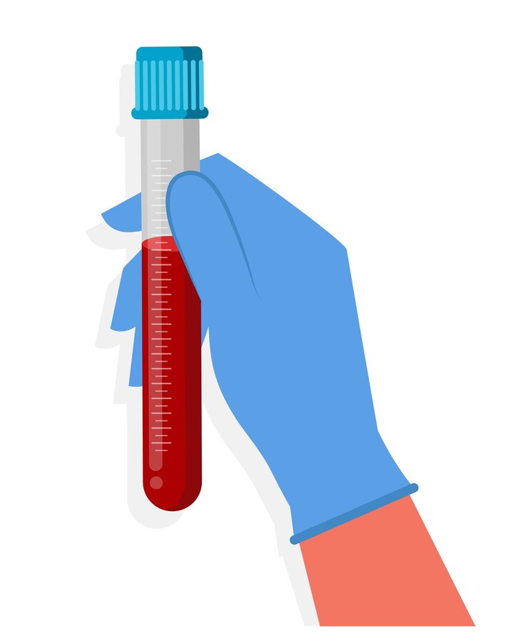 Vetor amostra de sangue em tubo de ensaio mantida pela mão do médico