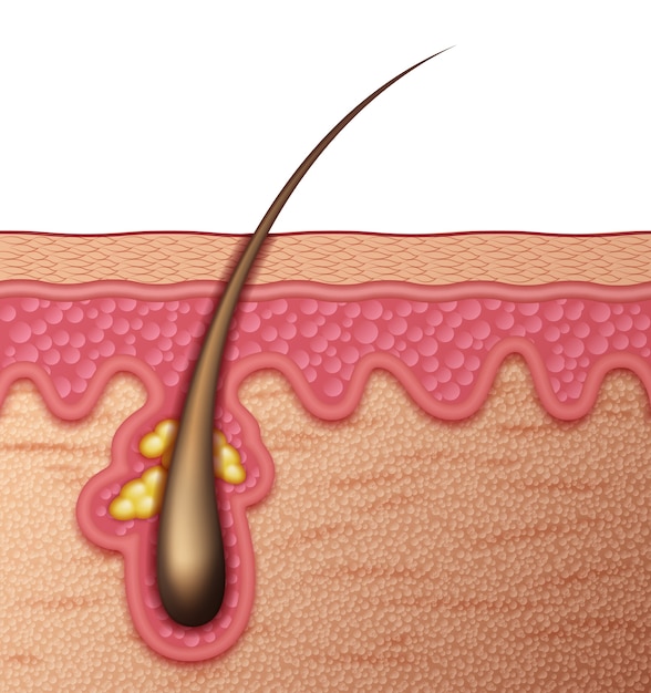 Vetor anatomia da pele humana cruzada vista lateral