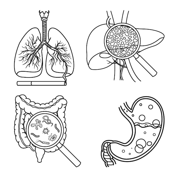 Vetor anatomia de órgãos humanos com várias doenças para coloração