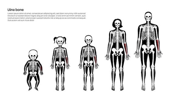 Vetor anatomia do osso ulnar