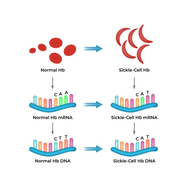 Anemia falciforme mRNA de DNA e mutação da hemoglobina