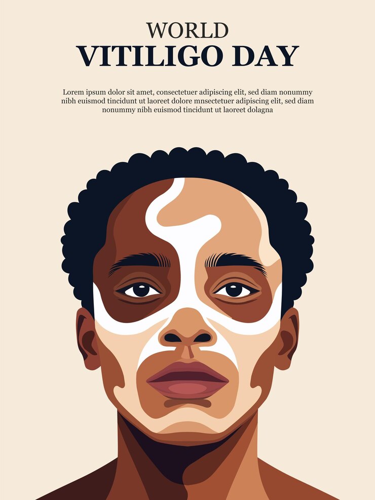 Vetor antecedentes do dia mundial da vitiligo
