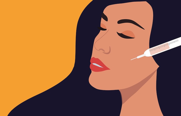 Vetor áreas de preenchimento dérmico e injeções de botox rosto de mulher com médico mãos em luvas com seringa