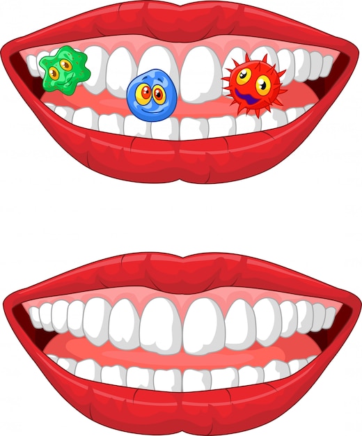 Vetor boca sorridente com micróbio