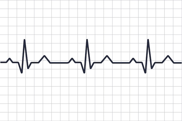 Cardiograma de doenças cardíacas. linha de pulsação. cardiogram. eletrocardiograma. monitor de pulso cardíaco com sinal