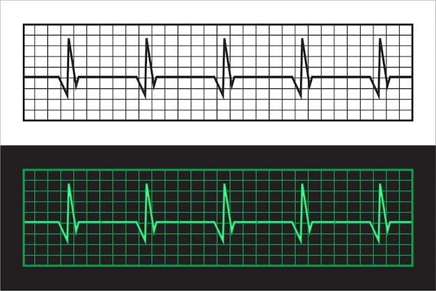 Cardiogramas de fita