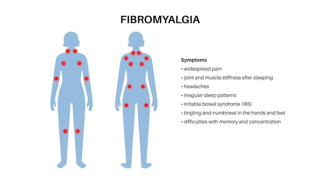 Vetor cartaz médico de fibromialgia