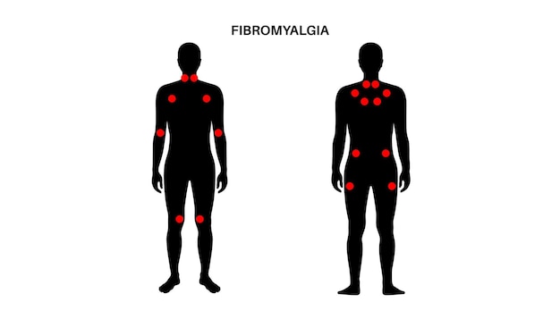 Vetor cartaz médico de fibromialgia