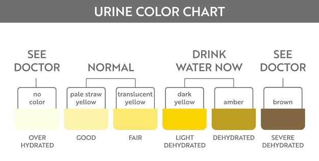 Vetor cartela de cores da urina. tira de teste de hidratação e desidratação de xixi. desenho vetorial para cartaz de educação médica.