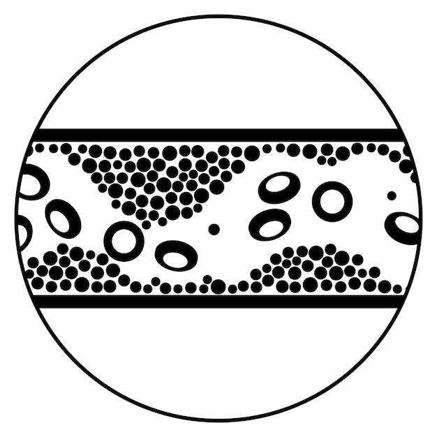 Vetor colesterol e aterosclerose