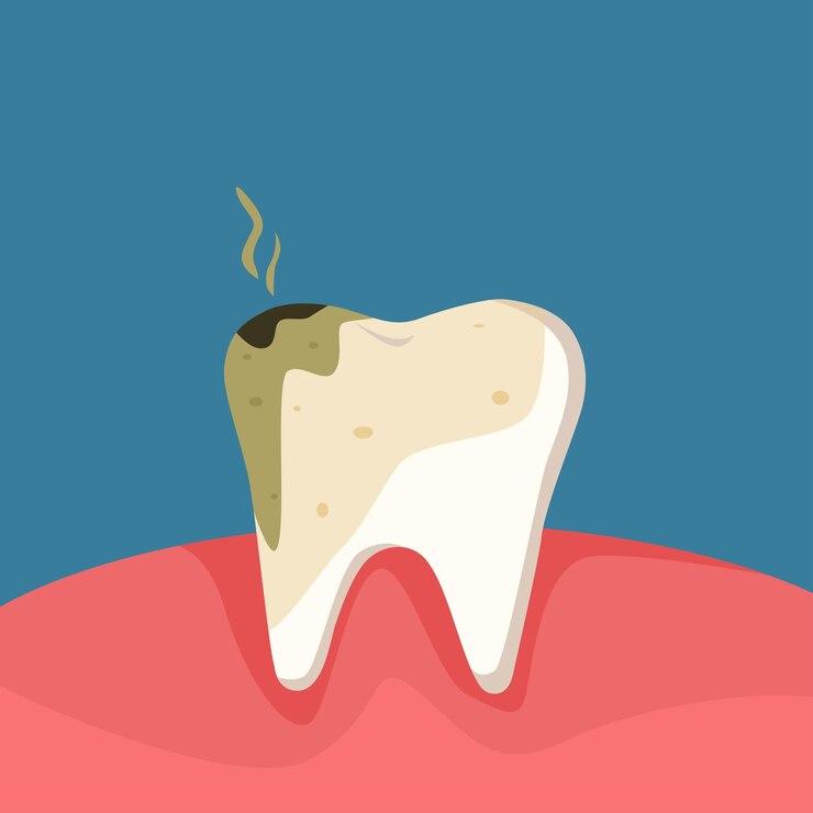 Conceito de cavidade dentáriaProblema dentário Dor de dente e mau hálito Cuidados bucais