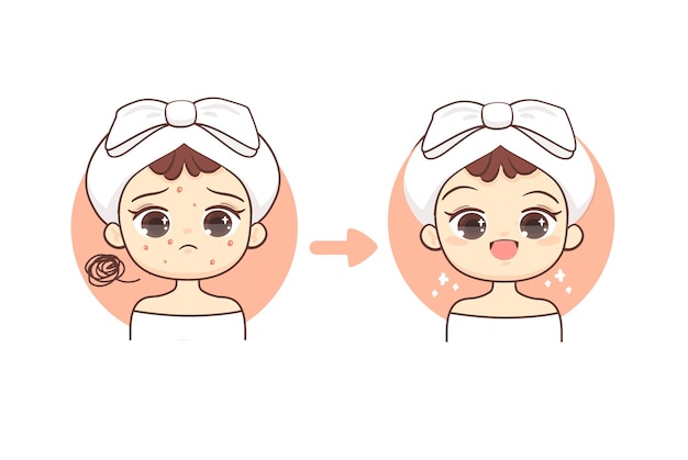 Conceito de cuidados com a pele linda garota kawaii com acne antes e depois do tratamento