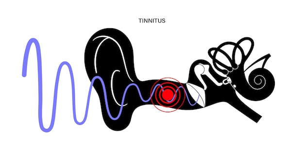 Vetor conceito de doença de zumbido