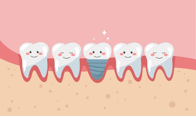 Conceito de implante dentário implantação dentária implantodontia e conceito de ortopedia