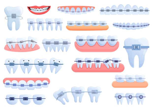 Vetor conjunto de ícones de aparelho dentário. conjunto de desenhos animados de ícones de aparelho dentário para a web