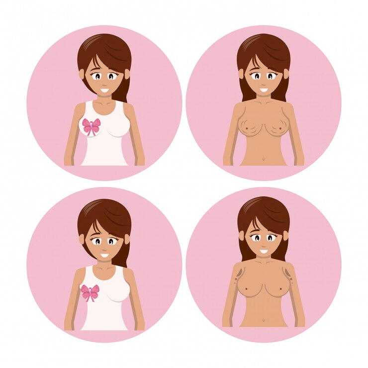 Vetor conjunto de ícones de câncer de mama