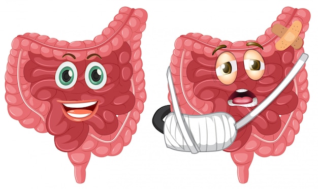 Conjunto de intestino saudável e lesionado