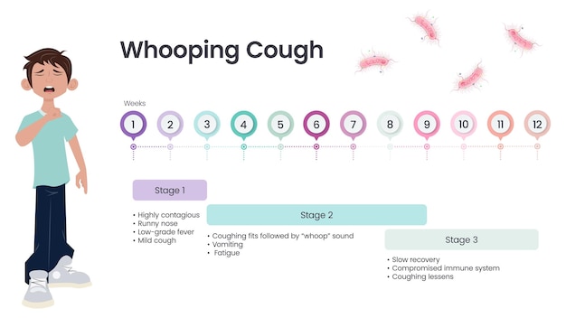 Coqueluche coqueluche sintoma timeline ilustração vetorial infográfico