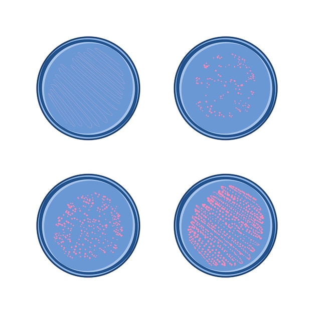 Vetor crescimento de bactérias em placa de petry 4 estágios de colônia de design plano de vetor de micróbios