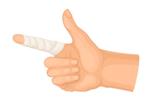 Vetor dedo indicador vendado por causa de lesão ou ilustração do vetor da ferida