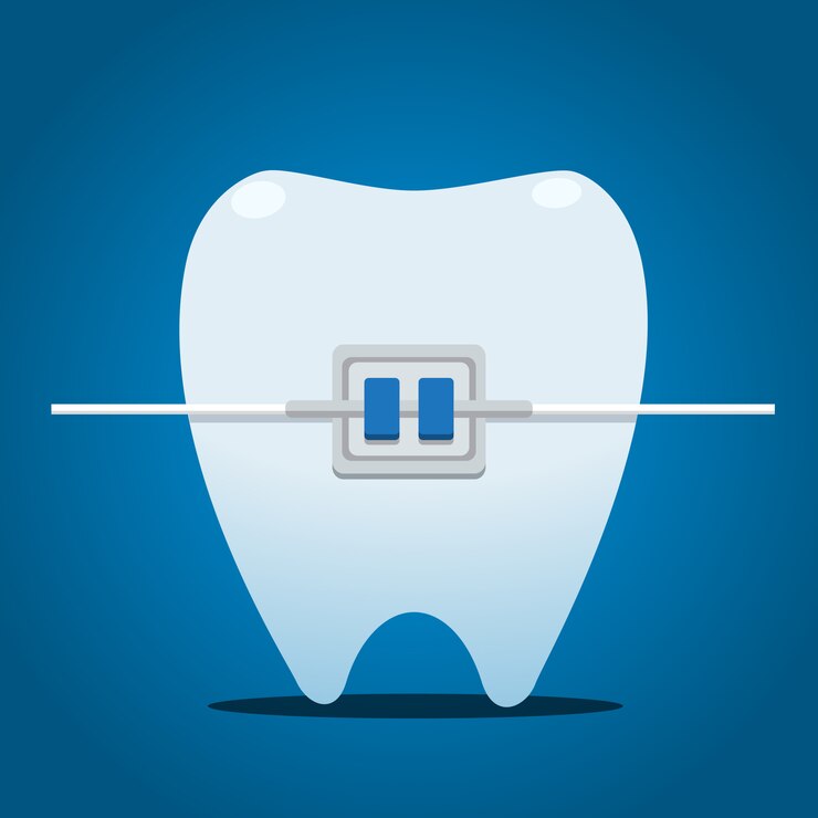 Vetor dente com chaves de metal. ilustração vetorial isolado