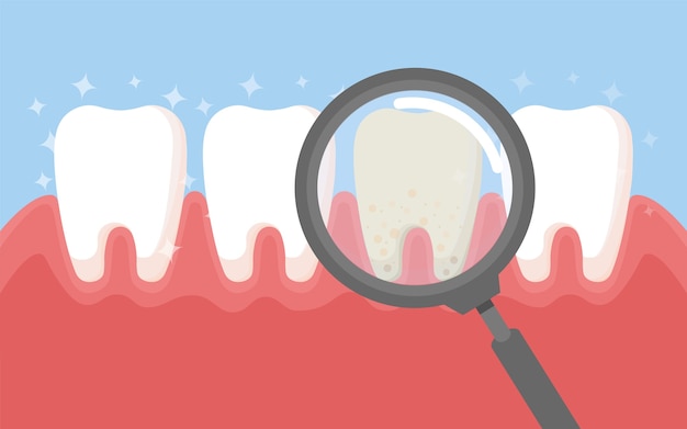 Dente com lupa. Odontologia limpa dente branco e instrumentos de odontologia. Higiene oral, limpeza dos dentes., Ilustração