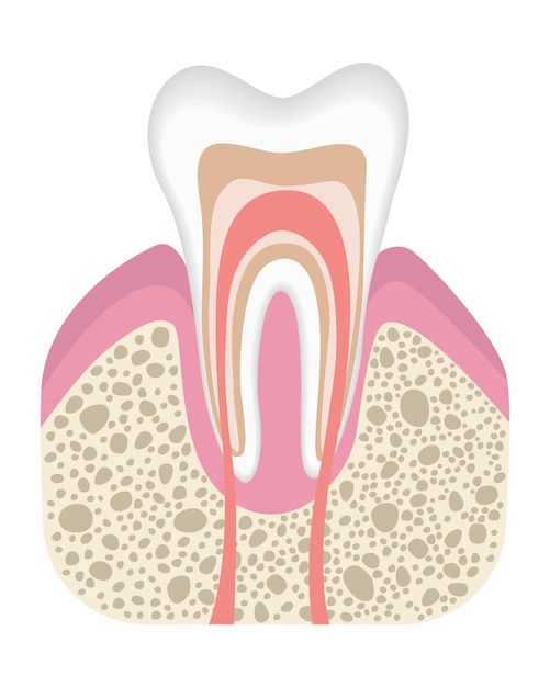 Vetor dente saudável não está infectado com cárie fase antes do desenvolvimento de cárie estrutura do dente em estilo plano dente com esmalte ilustração vetorial realista