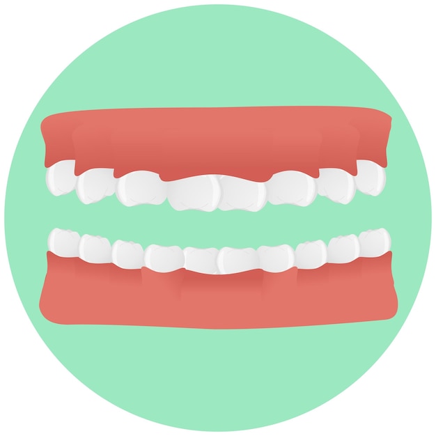 Vetor dentes de mandíbula montados em estilo realista ilustração vetorial colorida isolada no fundo