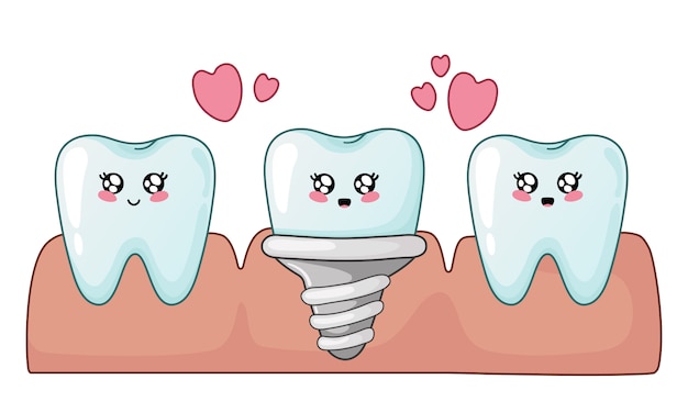 Dentes saudáveis dos desenhos animados do kawaii e implante dentário