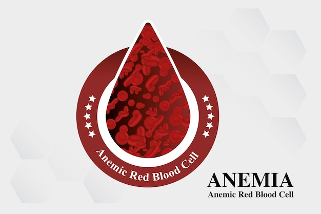 Diferença de anemia por deficiência de ferro de glóbulos vermelhos da quantidade de anemia e vetor de sintomas normais