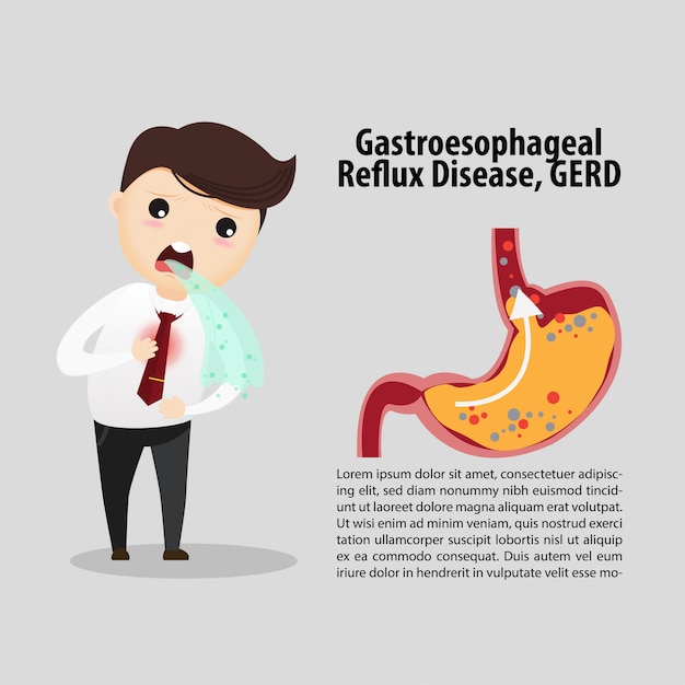 Doença do refluxo gastro-esofágico (drge)