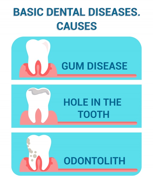 Doenças dentais básicas, problemas poster