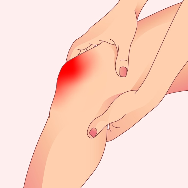 Vetor dor aguda no joelho artrite e problemas nos tendões joelho lesionado devido a fraturas túnel do carpo etc.